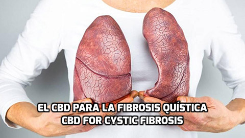 Lee más sobre el artículo El CBD para la Fibrosis Quística
