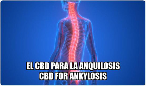 Lee más sobre el artículo El CBD para la Anquilosis