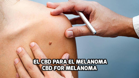 Lee más sobre el artículo El CBD para el Melanoma