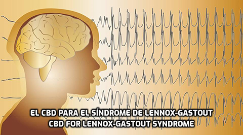 Lee más sobre el artículo El CBD para el Síndrome de Lennox-Gastaut