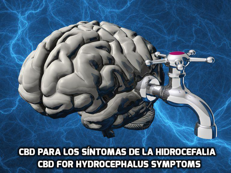 En este momento estás viendo El CBD para los síntomas de la Hidrocefalia