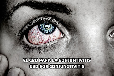 Lee más sobre el artículo El CBD para la Conjuntivitis